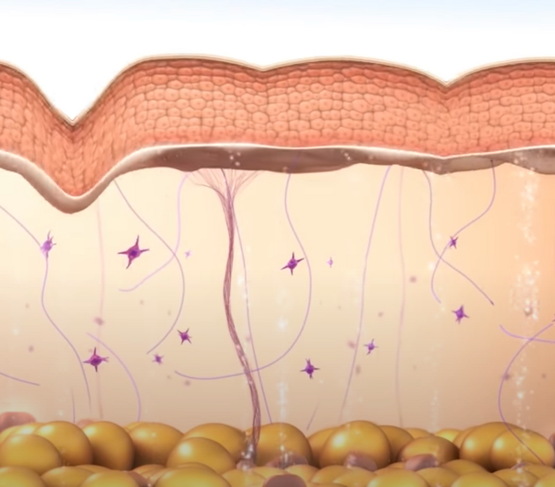 Illustration of human skin layers with hair follicles and fat cells.